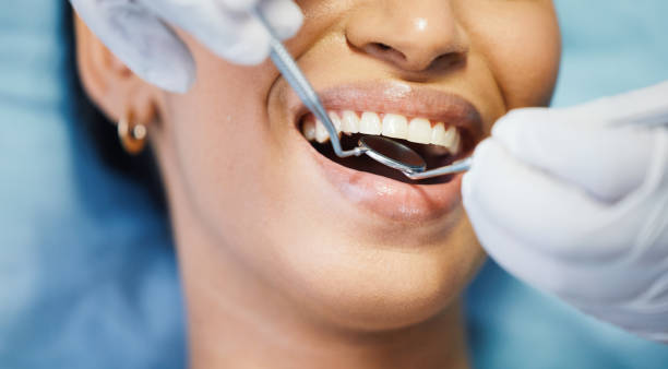 Best Emergency Root Canal Treatment in Damascus, MD