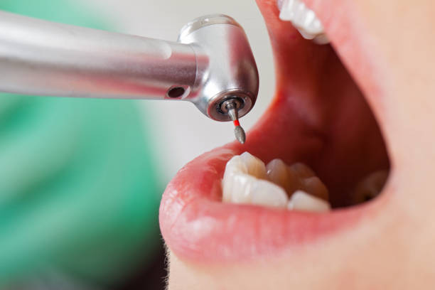 Best Cosmetic Emergency Dentistry in Damascus, MD
